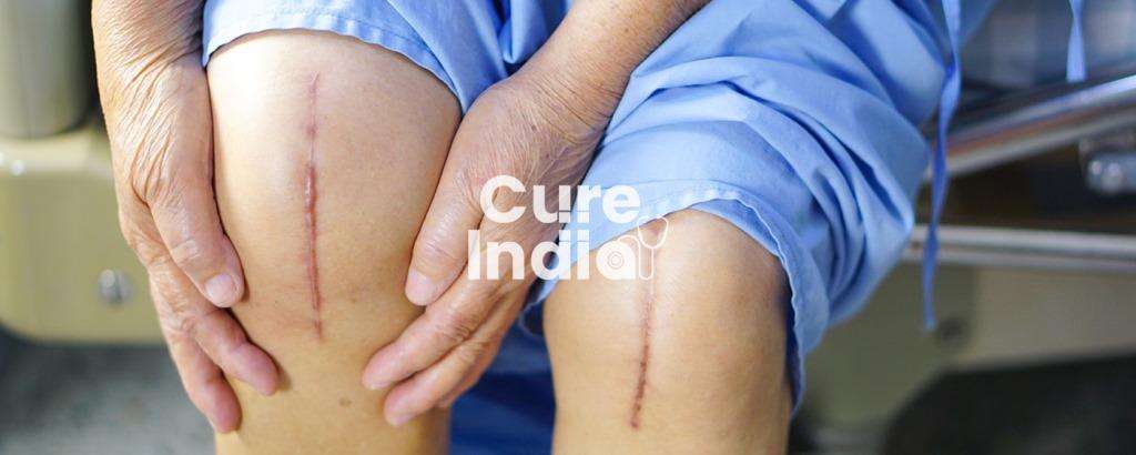 cureindia